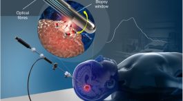 Precision Under Laser Lead: An Innovative Method for Tissue Analysis