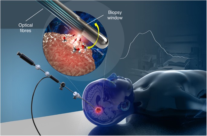 Precision Under Laser Lead: An Innovative Method for Tissue Analysis