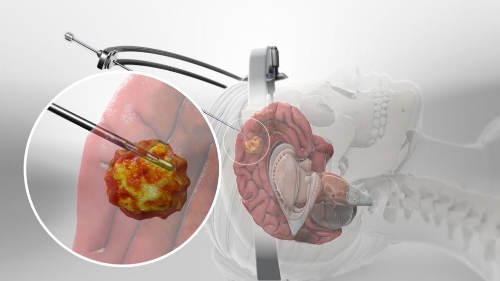 https://www.targetedbioscience.com/post/laser-capture-microdissection-protocol-for-efficient-tissue-analysis